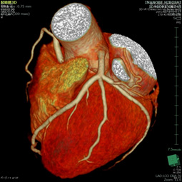 心臓CT検査画像